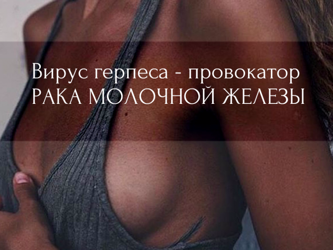 «Безобидный» вирус Эпштейн-Барр способствует развитию рака груди