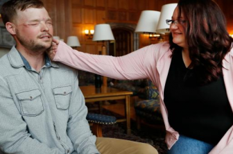 Мужчина, переживший успешную трансплантацию лица, встретился с семьей своего донора
