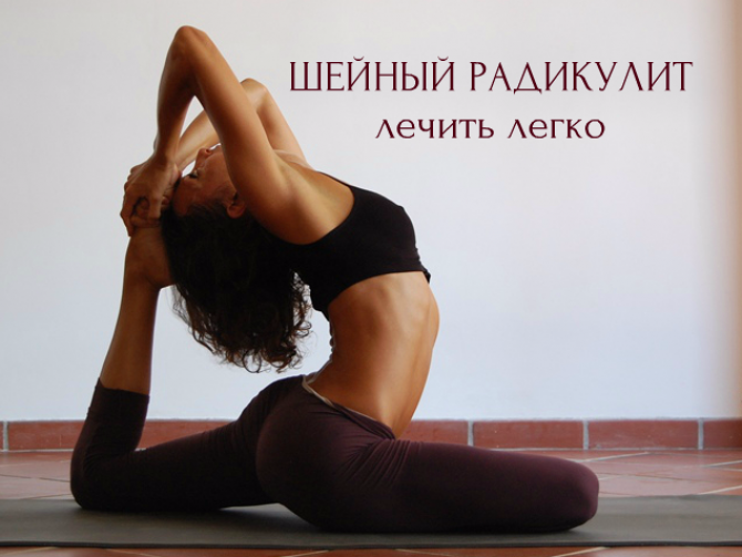 Шейный радикулит