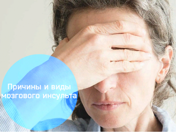 ЧТО ТАКОЕ МОЗГОВОЙ ИНСУЛЬТ?