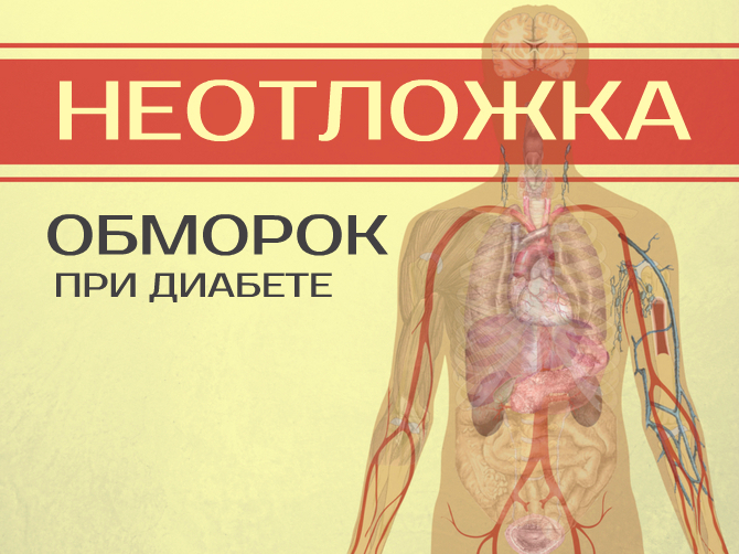 Гипогликемический обморок при диабете: что делать?