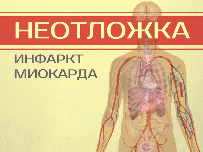 Как начинается инфаркт: просто о сложном. Признаки, стадии, осложнения