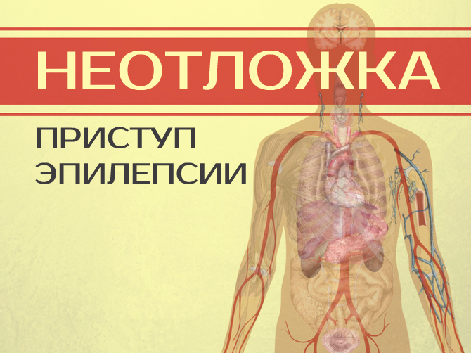Приступ эпилепсии: симптомы и первая помощь