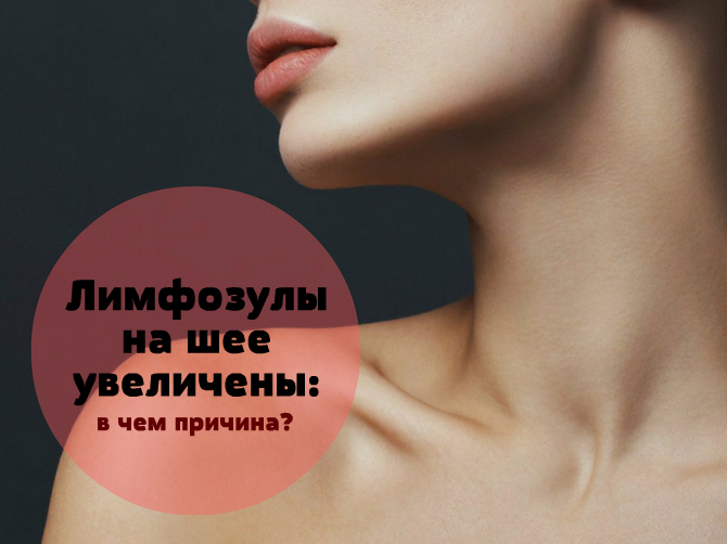 Увеличенные лимфоузлы на шее: как распознать болезнь