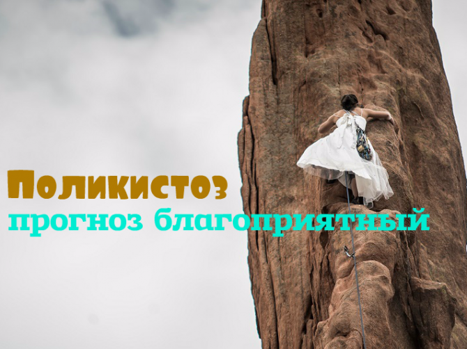 Поликистоз яичников: лечение
