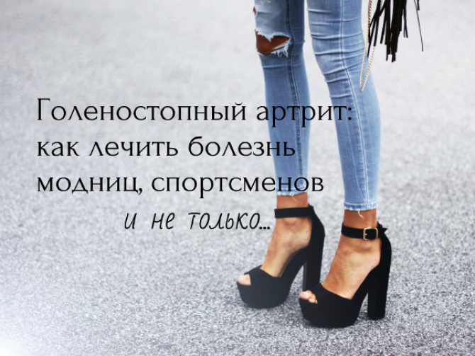 Артрит голеностопного сустава