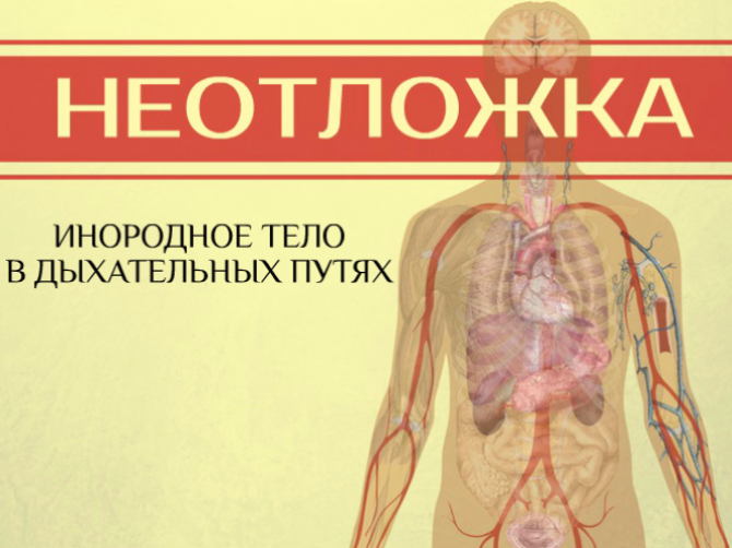 Что делать, если подавился?