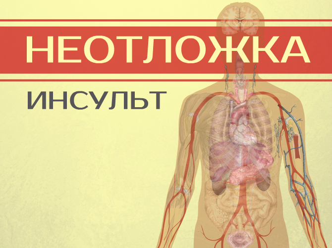 Как распознать первые признаки инсульта и оказать первую помощь