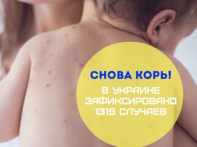 Снова корь