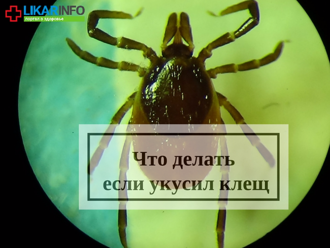 Что делать, если укусил клещ