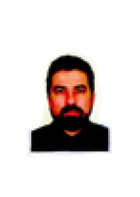 Добрый день.У меня анемия вызванная дефиц