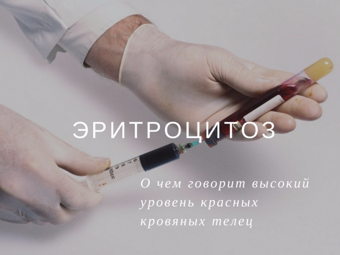 Эритроциты в крови повышены: причины, симптомы, лечение