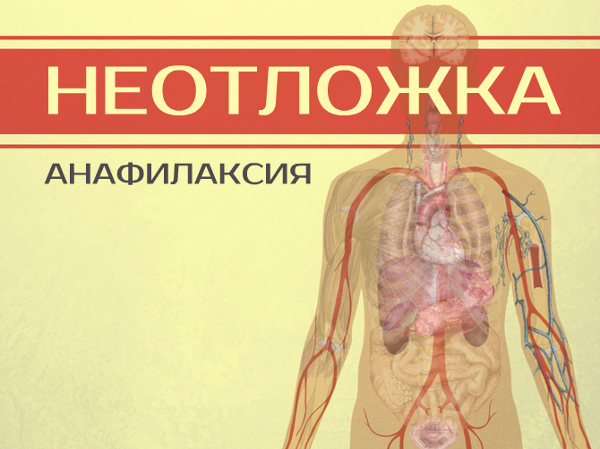 Неотложная помощь при анафилактическом шоке