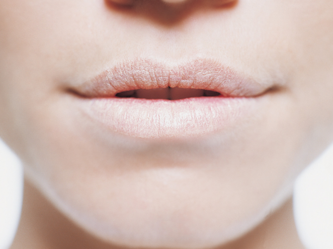 dry skin