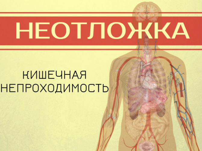 Первая помощь при острой кишечной непроходимости