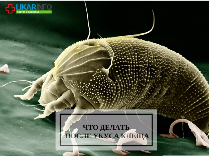 Что делать после укуса клеща