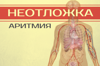 Как в домашних условиях снять приступ аритмии 769