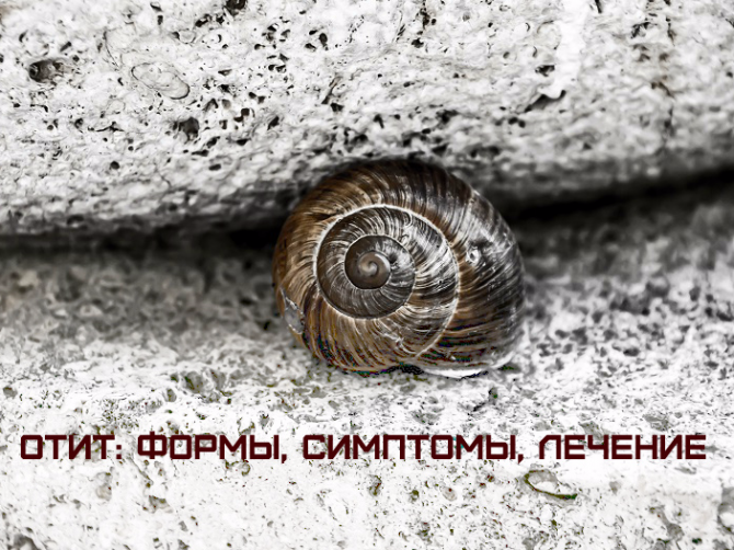 Острый средний отит
