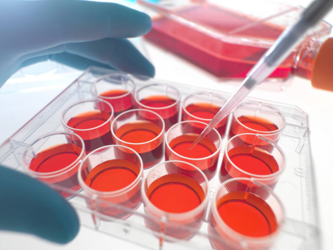 stem cells injection